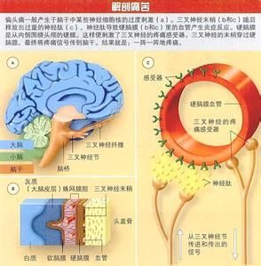 鈣拮抗劑