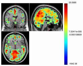 FMRI