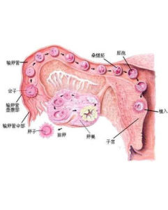 多囊性卵巢症候群