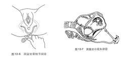 坐骨結節間徑和出口後矢狀徑