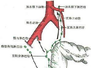 直腸腫瘤