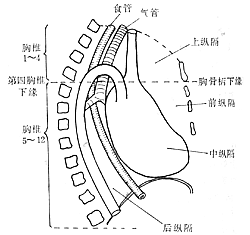 心包囊腫