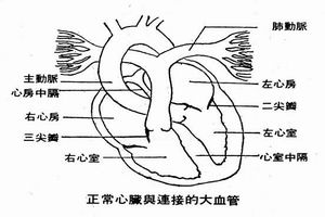 甲亢性心臟病