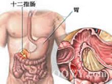 重金屬中毒性腎病