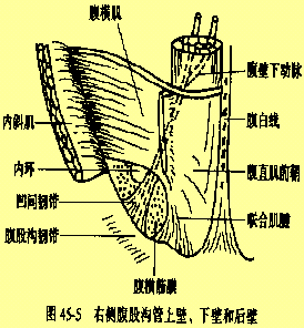 凹間韌帶