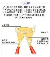 二尖瓣