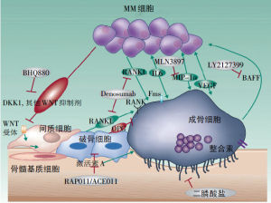 多發性骨髓瘤