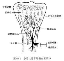 化膿性骨髓炎