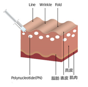 PN多核苷酸