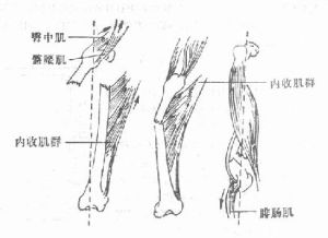 移位骨折