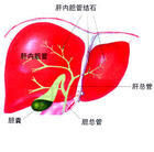 膽囊囊腫