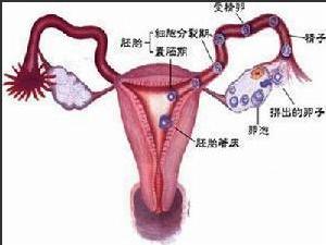 繼發性不孕