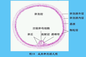 卵巢過度刺激綜合症