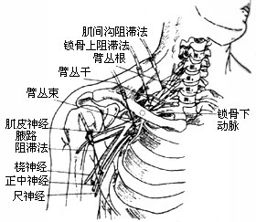 臂叢神經痛