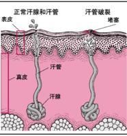 汗水的形成