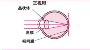 屈光系統