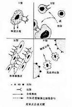 超敏反應