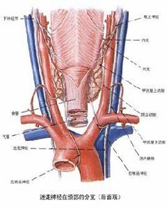 迷走神經阻斷術