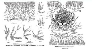 稀疏蜈蚣藻