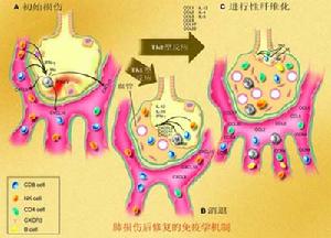 氧化應激