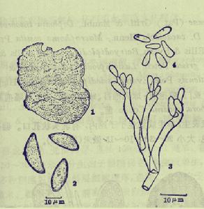 茶炭根腐病