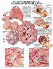 慢性阻塞性肺炎