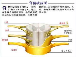 亞急性壞死性脊髓炎綜合症