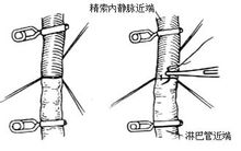 淋巴管近端