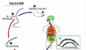 寄生蟲進入人體能治疑難雜症