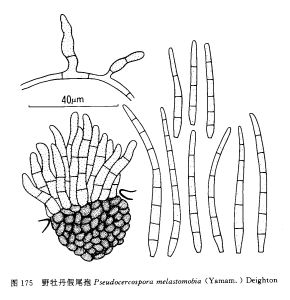 野牡丹假尾孢