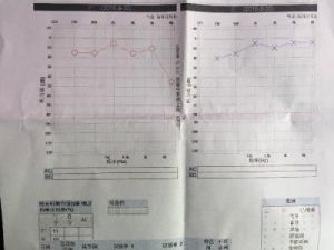 純音測聽