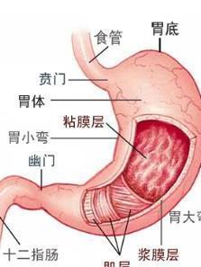 胃畸胎瘤