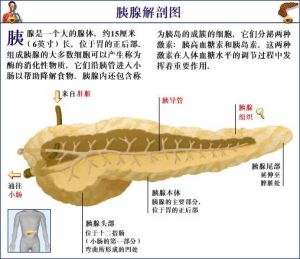 胰石症