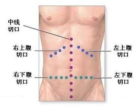 橫結腸