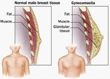 男性乳腺發育的組織學改變