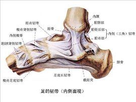 韌帶拉傷