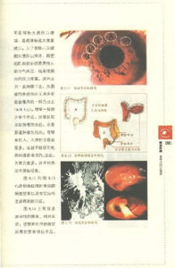 《解讀虹膜 看得見的亞健康》