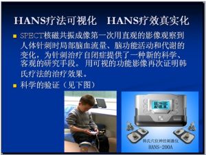 HANS療法可視化  HANS療效真實化