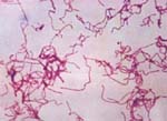 紅斑丹毒絲菌