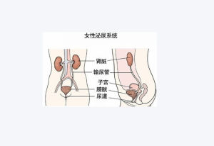 女性尿痛