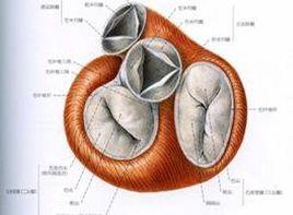 瓣膜增厚