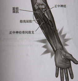 前骨間神經卡壓綜合徵