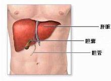 肝硬化腹水