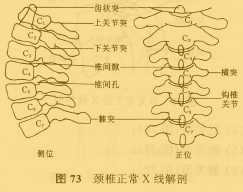 顱底陷入