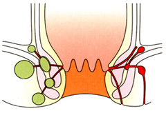 肛門紅腫