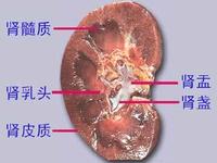 腎皮質壞死