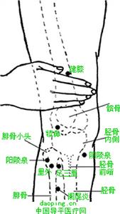 多發性骨骺發育不良