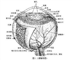 晶狀體相關葡萄膜炎