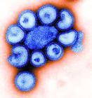 甲型H1N1變種病毒