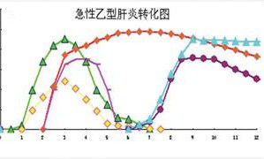 急性B型肝炎